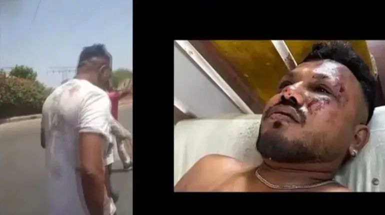 Air india crash survivor 1