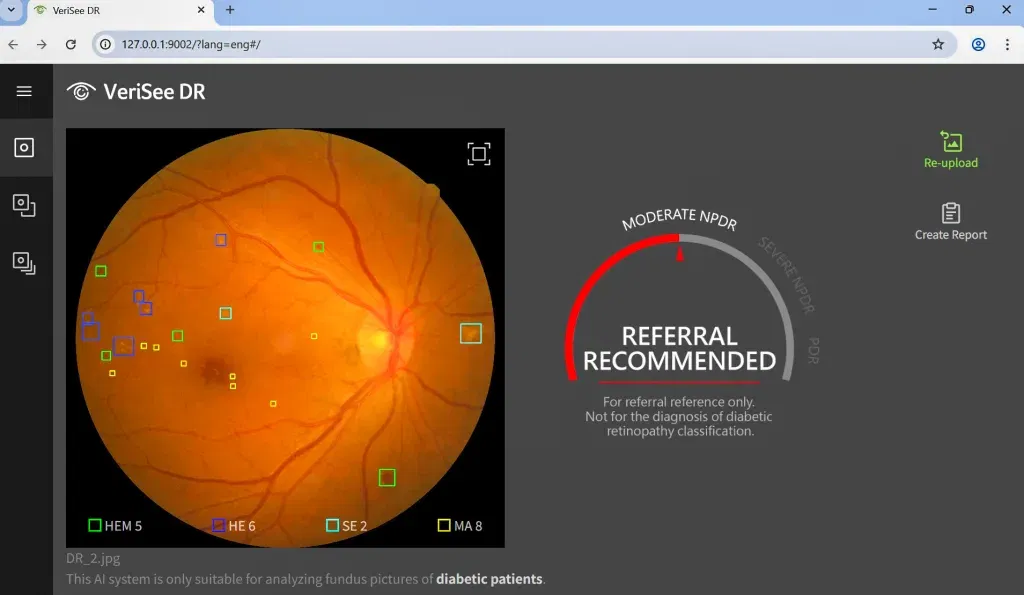 Acer medical aimed 2